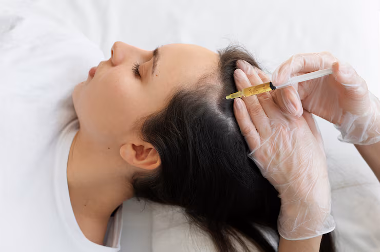 woman-getting-scalp-prp-treatment-high-angle_23-2149404693.avif