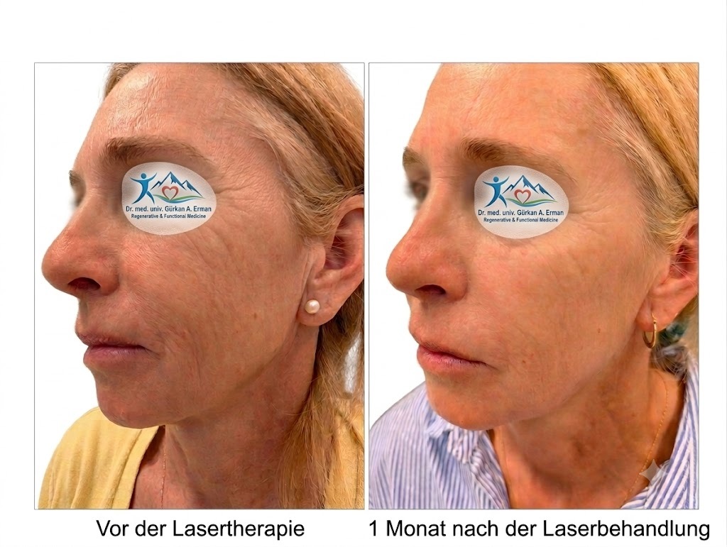 Vorher/Nachher – Fibrome entfernen